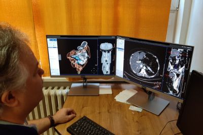 Virtuální kolonoskopií odhalují lékaři Podhorské nemocnice nejen onemocnění tlustého střeva