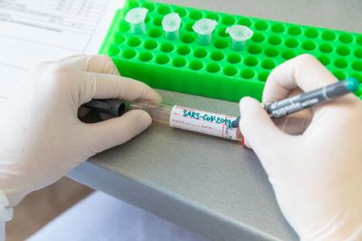 Podhorská nemocnice v Bruntále nově testuje samoplátce na SARS-CoV-2 